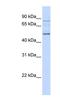 Flagellum Associated Containing Coiled-Coil Domains 1 antibody, NBP1-70405, Novus Biologicals, Western Blot image 