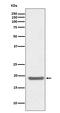 Superoxide Dismutase 1 antibody, M00238, Boster Biological Technology, Western Blot image 