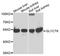 Glycerate Kinase antibody, STJ110162, St John