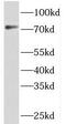 Phosphatidylinositol Glycan Anchor Biosynthesis Class O antibody, FNab06443, FineTest, Western Blot image 