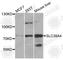 Solute Carrier Family 39 Member 4 antibody, A3454, ABclonal Technology, Western Blot image 