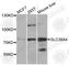 Zinc transporter ZIP4 antibody, A3454, ABclonal Technology, Western Blot image 