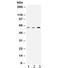 Catalase antibody, R32390, NSJ Bioreagents, Western Blot image 