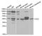 Tachykinin Receptor 1 antibody, TA332770, Origene, Western Blot image 