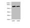 Protein Phosphatase, Mg2+/Mn2+ Dependent 1D antibody, LS-C676293, Lifespan Biosciences, Western Blot image 