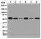 Lectin, Mannose Binding 1 antibody, ab125006, Abcam, Western Blot image 