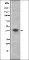 CD72 Molecule antibody, orb336918, Biorbyt, Western Blot image 