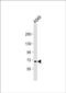 Ring Finger Protein 43 antibody, PA5-48529, Invitrogen Antibodies, Western Blot image 