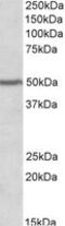 Paired box protein Pax-1 antibody, LS-C139737, Lifespan Biosciences, Western Blot image 