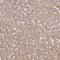 UTP23 Small Subunit Processome Component antibody, PA5-60705, Invitrogen Antibodies, Immunohistochemistry paraffin image 