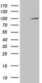 Glycogen Phosphorylase, Muscle Associated antibody, TA811315S, Origene, Western Blot image 