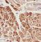 Protein Phosphatase 3 Catalytic Subunit Beta antibody, FNab06728, FineTest, Immunohistochemistry frozen image 