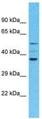 Olfactory Receptor Family 4 Subfamily F Member 4 antibody, TA337505, Origene, Western Blot image 
