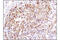 Ribosomal Protein S6 Kinase A3 antibody, 11989S, Cell Signaling Technology, Immunohistochemistry paraffin image 