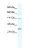 Gap Junction Protein Beta 4 antibody, orb329879, Biorbyt, Western Blot image 