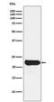 Glutathione Peroxidase 2 antibody, M03837, Boster Biological Technology, Western Blot image 