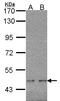 WT1 Transcription Factor antibody, LS-C109316, Lifespan Biosciences, Western Blot image 