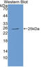 TIMP Metallopeptidase Inhibitor 3 antibody, LS-C314410, Lifespan Biosciences, Western Blot image 