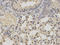Inhibitor Of Nuclear Factor Kappa B Kinase Subunit Epsilon antibody, LS-C330861, Lifespan Biosciences, Immunohistochemistry frozen image 