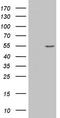 Alpha-Methylacyl-CoA Racemase antibody, LS-C338503, Lifespan Biosciences, Western Blot image 