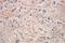 Glutamate Rich WD Repeat Containing 1 antibody, 10354-1-AP, Proteintech Group, Immunohistochemistry paraffin image 