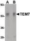 Plexin Domain Containing 1 antibody, PA5-20428, Invitrogen Antibodies, Western Blot image 
