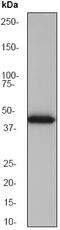 Keratin 15 antibody, ab52816, Abcam, Western Blot image 