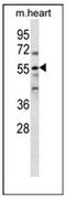 PARP2 antibody, AP53165PU-N, Origene, Western Blot image 