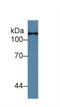 Toll Like Receptor 5 antibody, LS-C314267, Lifespan Biosciences, Western Blot image 