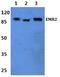 Adhesion G Protein-Coupled Receptor E2 antibody, A08546-1, Boster Biological Technology, Western Blot image 