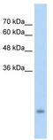 Pregnancy Specific Beta-1-Glycoprotein 3 antibody, TA329452, Origene, Western Blot image 