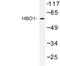 Lysine Acetyltransferase 7 antibody, LS-C176890, Lifespan Biosciences, Western Blot image 