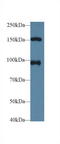 Nucleoporin 98 antibody, LS-C295701, Lifespan Biosciences, Western Blot image 