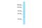 GTF2I Repeat Domain Containing 2B antibody, A16119, Boster Biological Technology, Western Blot image 