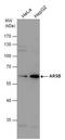 Arylsulfatase B antibody, GTX102829, GeneTex, Western Blot image 