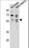 Ankyrin Repeat Domain 34C antibody, LS-C156350, Lifespan Biosciences, Western Blot image 