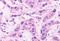 Cadherin EGF LAG Seven-Pass G-Type Receptor 2 antibody, NLS1943, Novus Biologicals, Immunohistochemistry paraffin image 