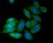 NADH:Ubiquinone Oxidoreductase Subunit A13 antibody, A05981-1, Boster Biological Technology, Immunocytochemistry image 