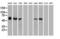 Checkpoint Kinase 2 antibody, LS-C114497, Lifespan Biosciences, Western Blot image 