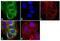 Keratin 8 antibody, MA5-14088, Invitrogen Antibodies, Immunofluorescence image 