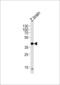Eukaryotic Translation Initiation Factor 3 Subunit E antibody, LS-C157708, Lifespan Biosciences, Western Blot image 