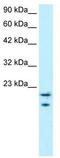 MYC Binding Protein antibody, TA329426, Origene, Western Blot image 