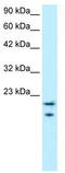 MYC Binding Protein antibody, TA329426, Origene, Western Blot image 