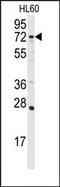 Diacylglycerol Kinase Alpha antibody, AP15096PU-N, Origene, Western Blot image 