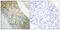 Insulin Receptor antibody, LS-C117655, Lifespan Biosciences, Immunohistochemistry paraffin image 