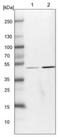 MAPK Associated Protein 1 antibody, NBP1-89569, Novus Biologicals, Western Blot image 