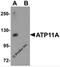 ATPase Phospholipid Transporting 11A antibody, 5855, ProSci Inc, Western Blot image 
