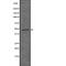 Hyaluronan And Proteoglycan Link Protein 1 antibody, abx215816, Abbexa, Western Blot image 