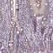 Endoplasmic reticulum mannosyl-oligosaccharide 1,2-alpha-mannosidase antibody, NBP2-14216, Novus Biologicals, Immunohistochemistry paraffin image 