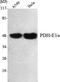 Pyruvate Dehydrogenase E1 Alpha 1 Subunit antibody, STJ98528, St John